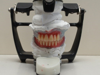 西区伊藤歯科総入れ歯つくりその２歯並びの配列